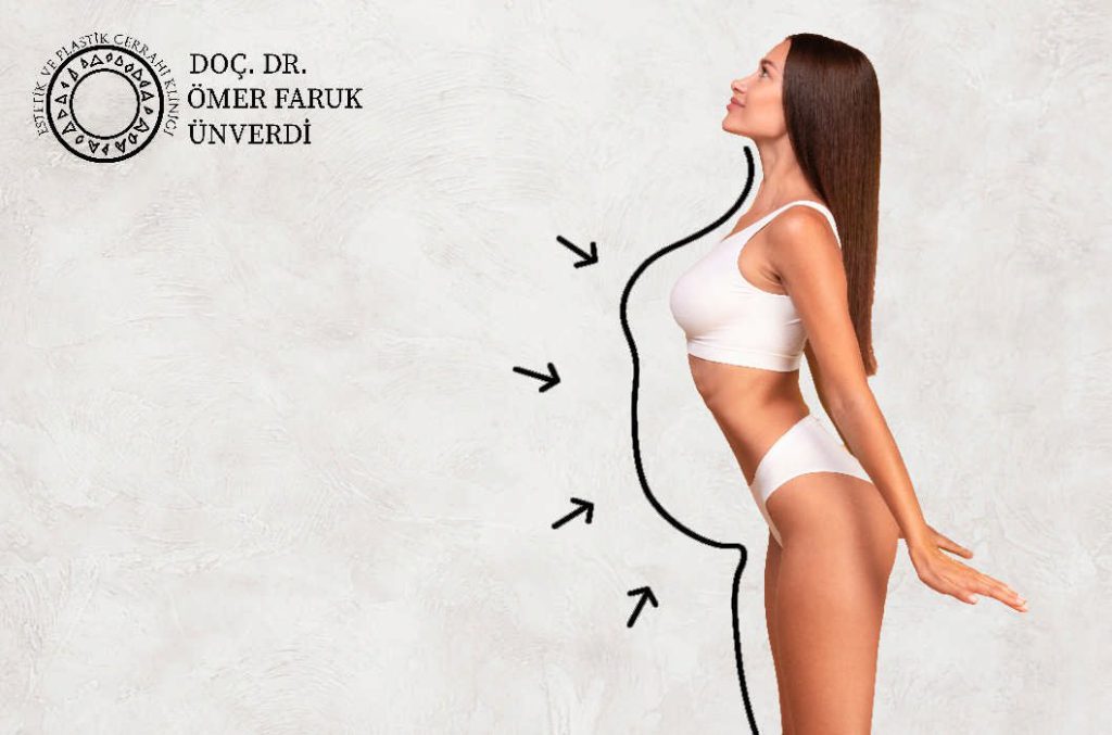 Liposuction